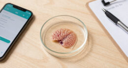 Lab-grown Mini Brains May Predict Which Alzheimer’s Treatments Will Work
